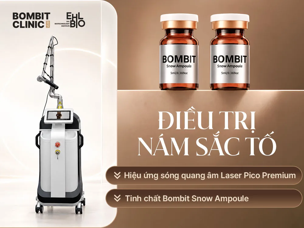 Sắc tố - Nám